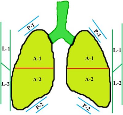 Application of ultrasonography in neonatal lung disease: An updated review